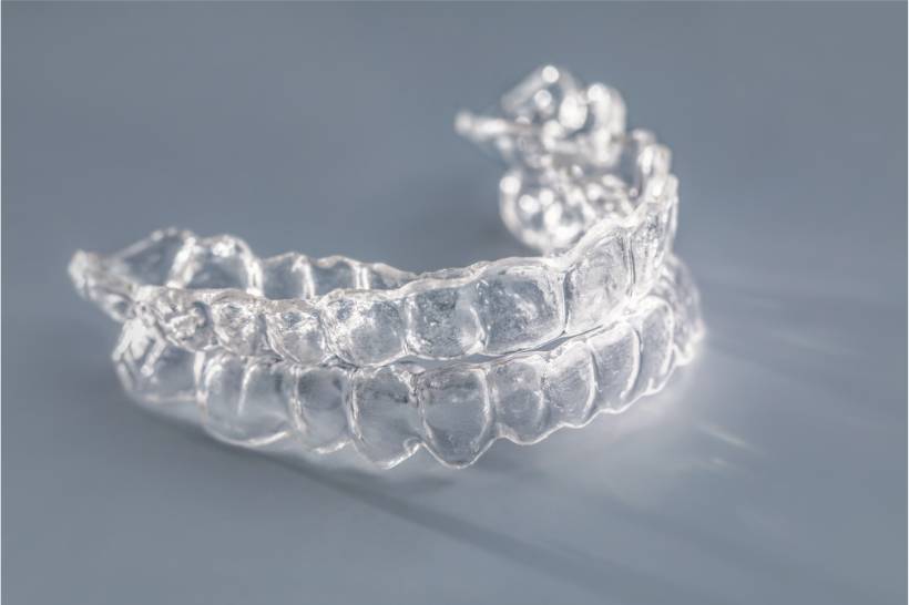 Why Retainers Matter
