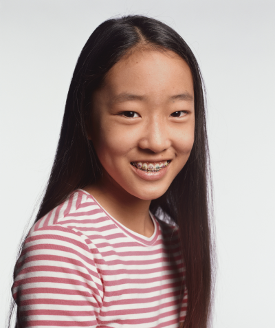 Two Phases Treatment - RH Orthodontics