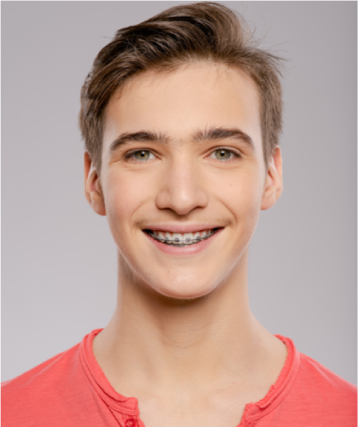 The Teen Treatment - RH Orthodontics