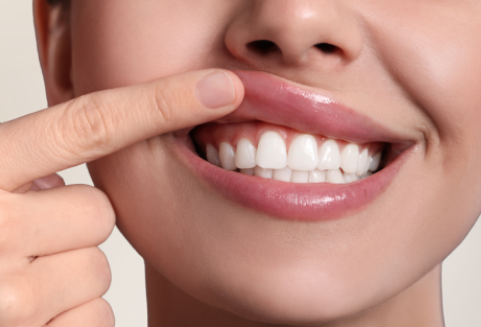 from gum balance to jaw