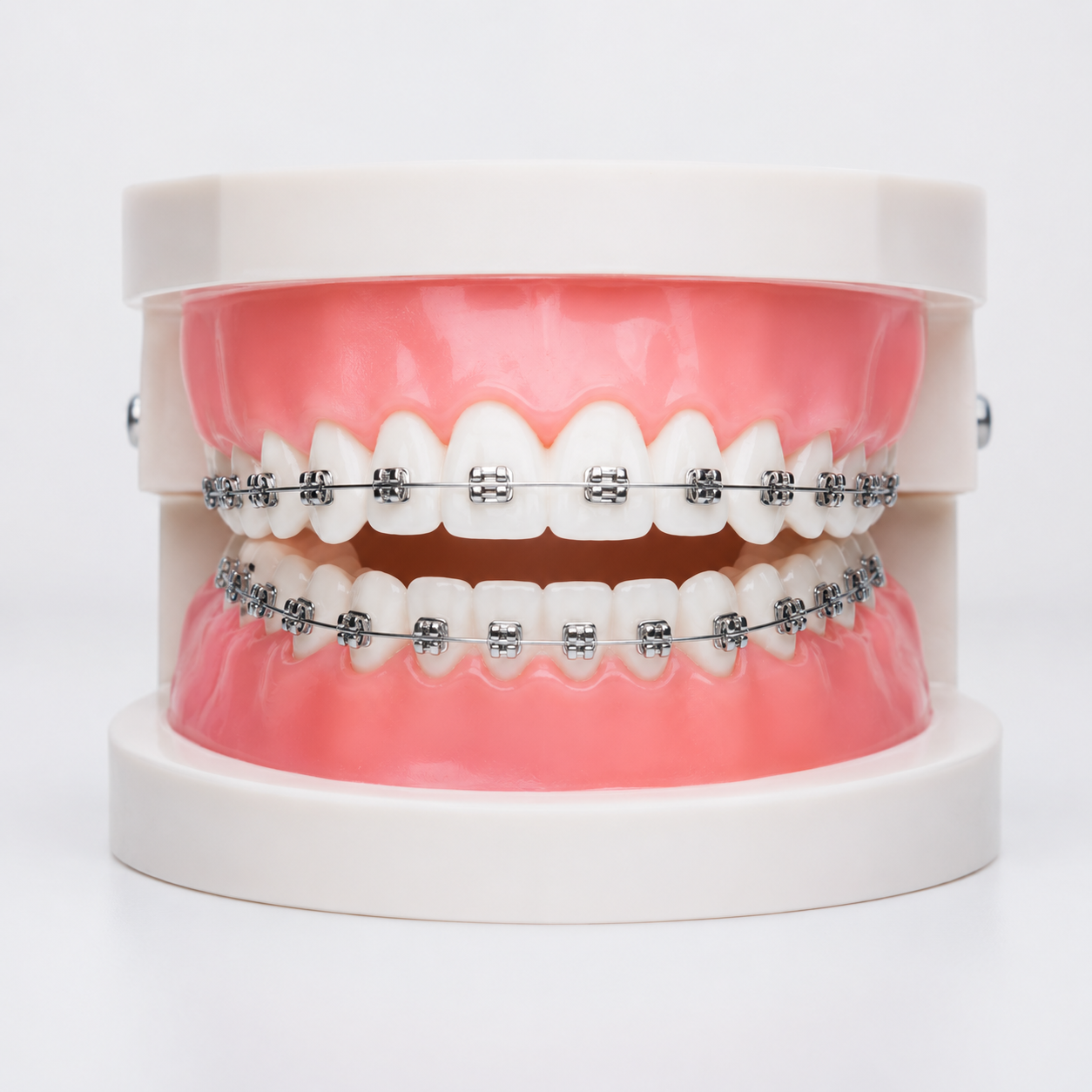 metal braces in the colony tx