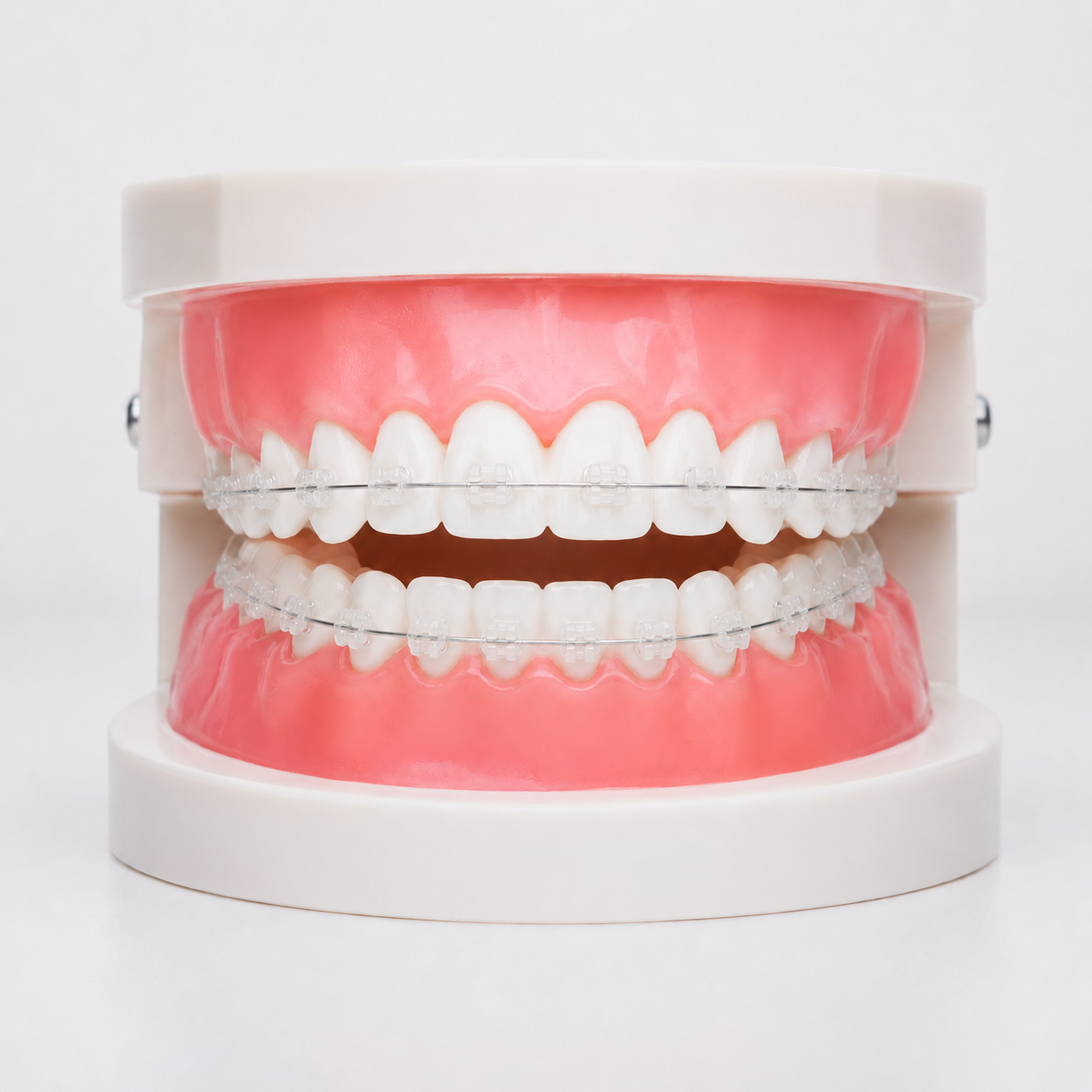 clear braces in the colony tx