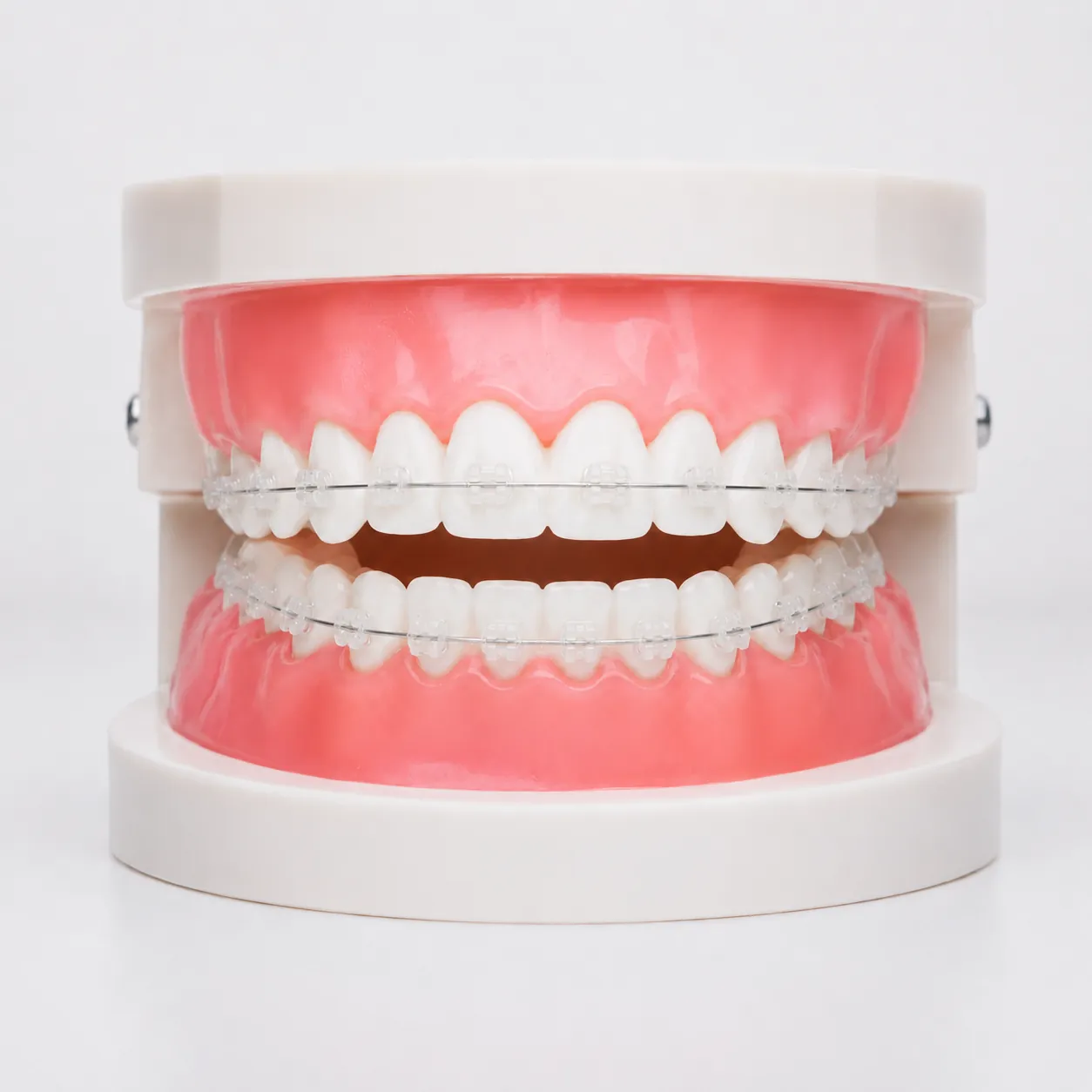Dental model with clear aligners