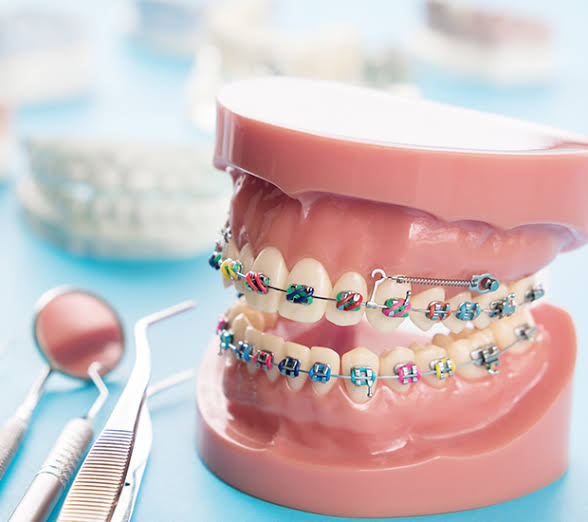 typodont with braces